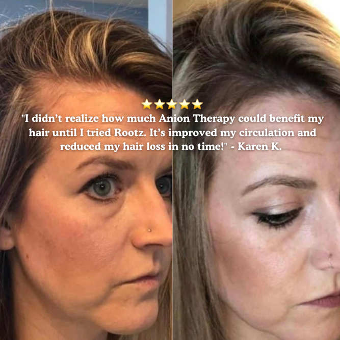 NEW Rootz™ 2.0 : Anion Therapy scalp massager